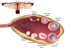 卵巣　生理痛の原因