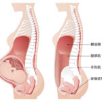 妊婦　おなかのケア