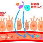 リーキーガット症候群による腸漏れ