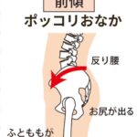 骨盤の前傾