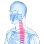 カイロプラクティックの背骨ケア