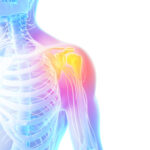 shoulder-pain